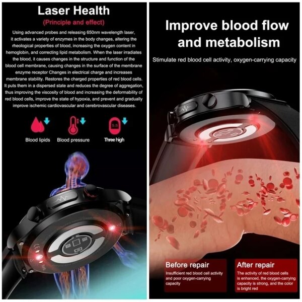 XIAOMI IOS 650nm Laser Therapy Health Smart Watch Men ECG+PPG Blood Lipids Uric Acid Heart Rate Fitness Tracking Smartwatch - Image 2